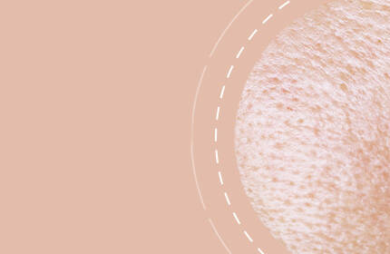 Close-up of textured skin with a light beige background.
