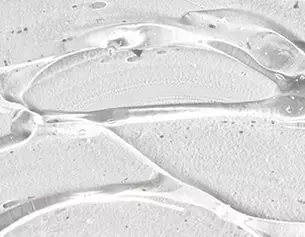 Textura de gel transparente sobre una superficie blanca, con burbujas visibles y formas onduladas.