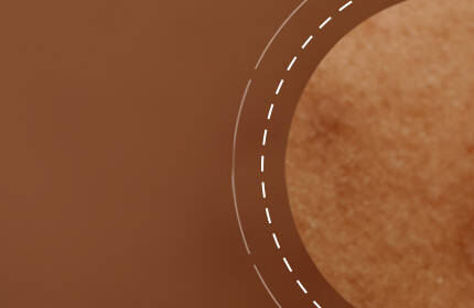 Close-up of a textured skin surface with a warm, brown background.