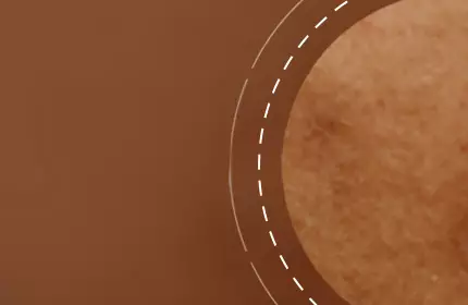 Close-up of a textured skin surface with a warm, brown background.