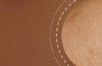 A close-up of a textured skin surface with warm brown tones. The image features a circular area highlighting small freckles or blemishes, set against a soft, neutral background.