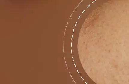 A close-up of a textured skin surface with warm brown tones. The image features a circular area highlighting small freckles or blemishes, set against a soft, neutral background.