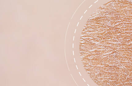 Close-up of textured skin with a light, neutral background.