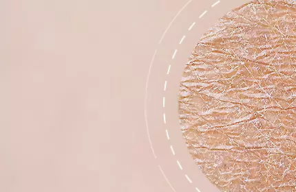 Close-up of textured skin with a light, neutral background.