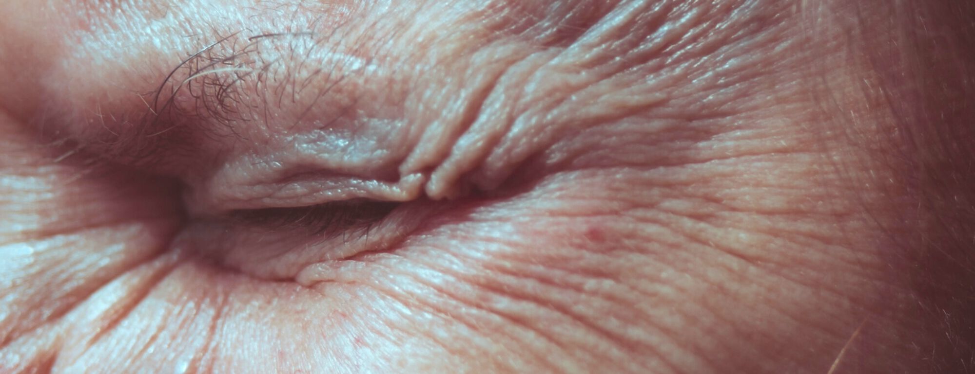 Cierre de un ojo envejecido, mostrando arrugas y textura de la piel, resaltando el paso del tiempo.