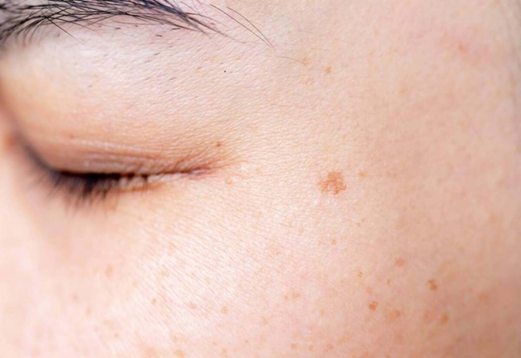 Primer plano de una piel facial con un tono saludable y algunas manchas pequenas, mostrando texturas y un ojo cerrado.