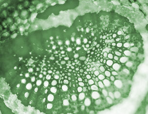 Imagen macro de una estructura celular con patrones circulares en tonos verdes, mostrando detalles botanicos.