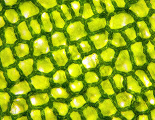 Microscopio de celulas vegetales verdes con estructuras en forma de red que muestran los cloroplastos en su interior.