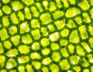 Microscopio de celulas vegetales verdes con estructuras en forma de red que muestran los cloroplastos en su interior.