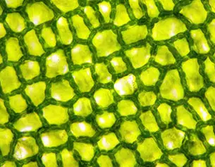 Microscopio de celulas vegetales verdes con estructuras en forma de red que muestran los cloroplastos en su interior.