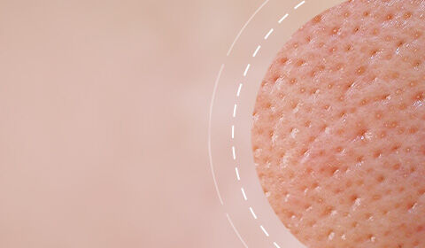 Close-up of textured skin surface with a soft, peach-colored background.