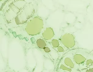 Vista microscopica de celulas con tonos verdes y estructuras ovaladas, mostrando la complejidad del tejido.