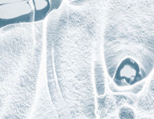 Textura de hielo azul claro con formas abstractas y reflejos en un fondo claro.