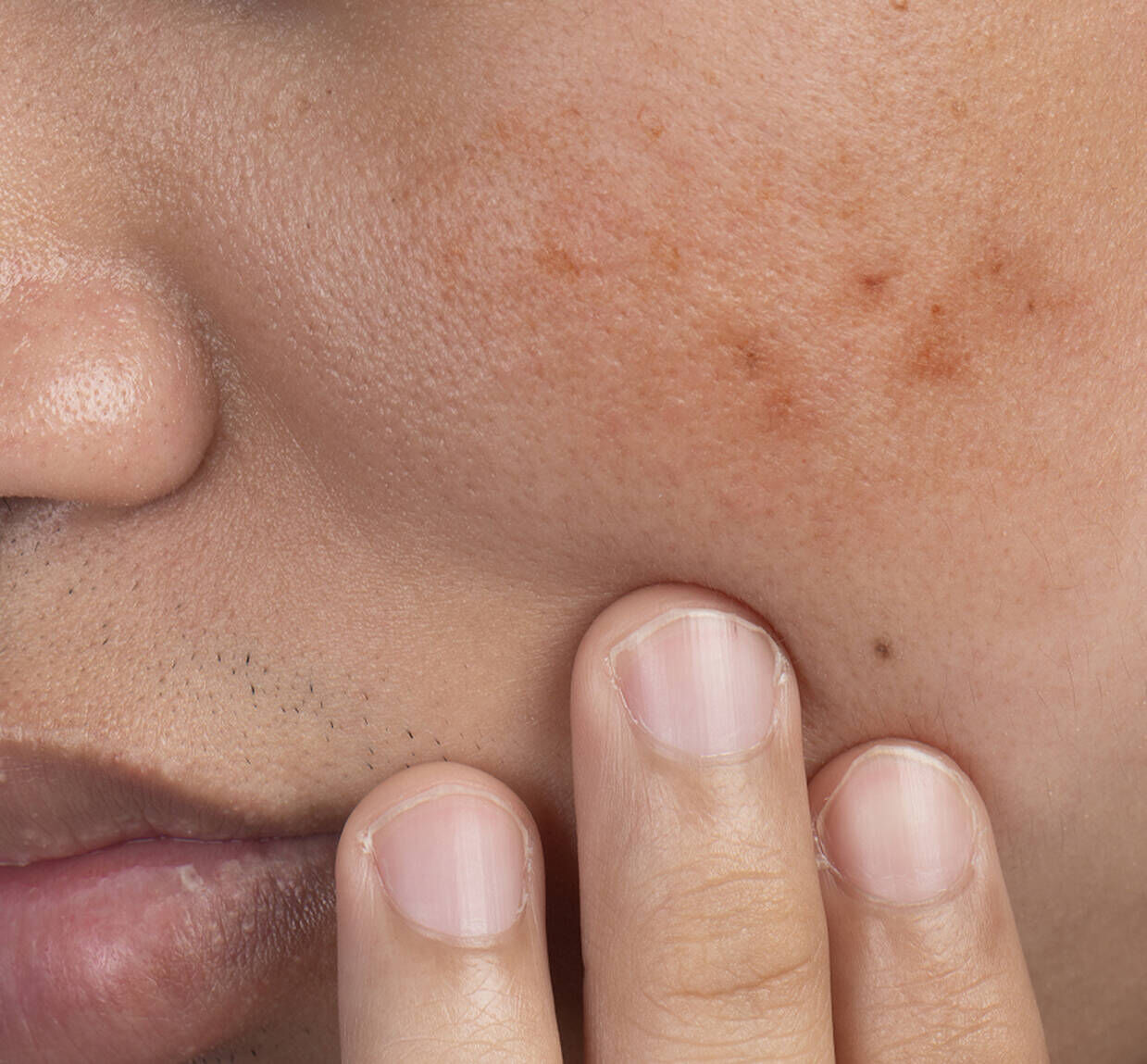 Corrective moisturizers