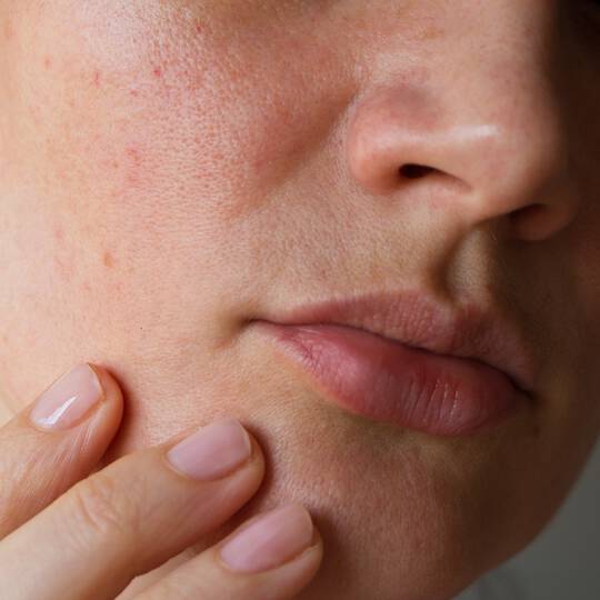 discoloration defense serum