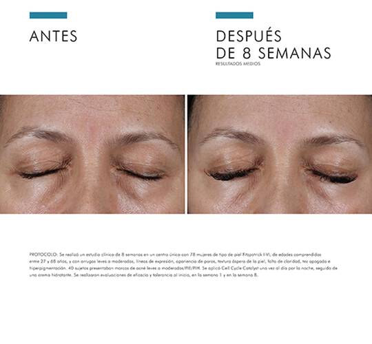 Imagen que muestra el antes y despues de un tratamiento en los ojos tras 8 semanas. Mejoria visible en la piel.