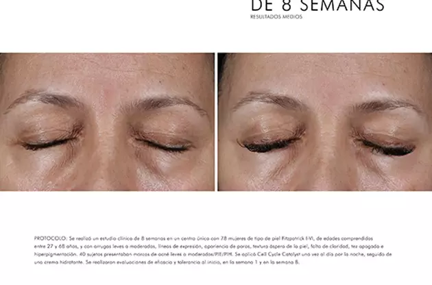 Imagen que muestra el antes y despues de un tratamiento en los ojos tras 8 semanas. Mejoria visible en la piel.