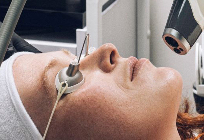 Mujer en tratamiento estetico con dispositivo laser, con los ojos protegidos y mirada relajada en un entorno clinico.