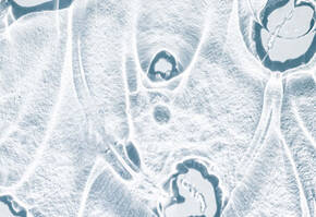 Abstract close-up of frosty ice patterns with smooth, flowing shapes and dark, organic forms embedded within.