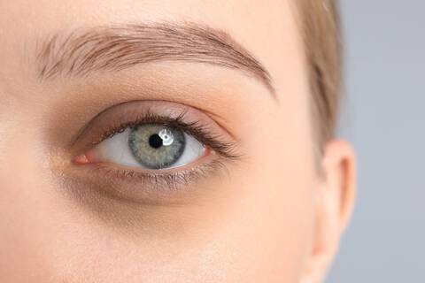como quitar las ojeras y bolsas en los ojos