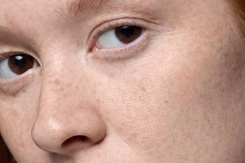 Causas-De-Las-Manchas-Skinceuticals-1