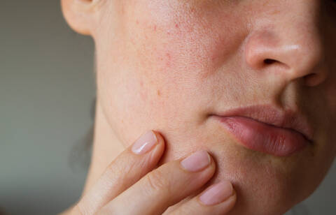 Causas-De-Las-Manchas-Skinceuticals-1