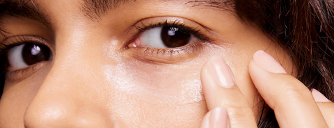 Tipos-De-Ojeras-Tratamientos-Skinceuticals-1