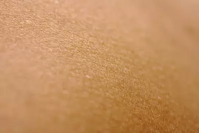piel seca deshidratada