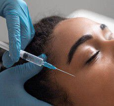 LE MICRONEEDLING