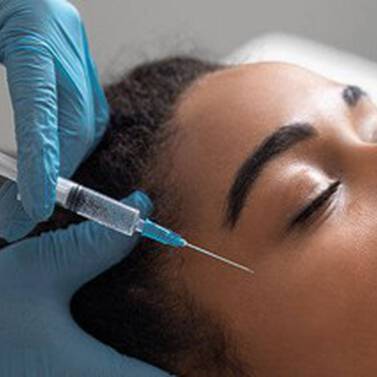 LE MICRONEEDLING