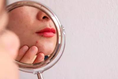 Causas-De-Las-Manchas-Skinceuticals-1