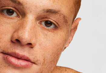 Primer plano del rostro de una persona con piel clara y pecas, mostrando sus ojos y labios.