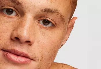 Primer plano del rostro de una persona con piel clara y pecas, mostrando sus ojos y labios.
