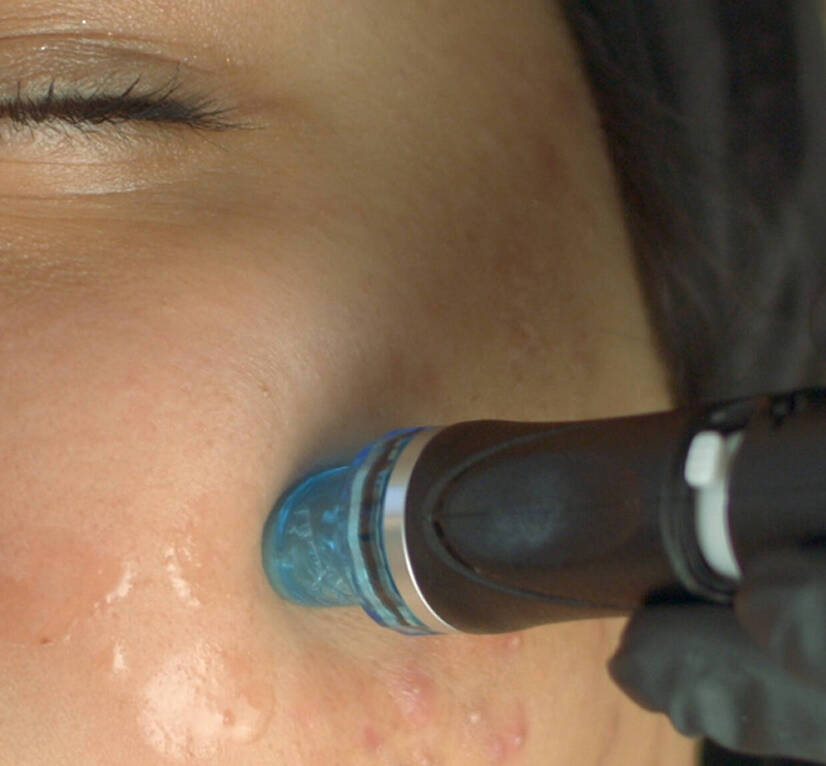How Antioxidant Serum Works