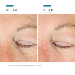 A.G.E. Advanced Eye Crema Antiojeras