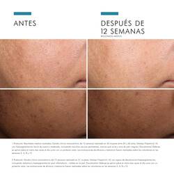 Discoloration Defense Serum Despigmentante