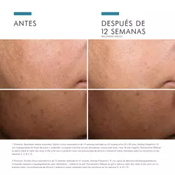 Discoloration Defense Serum Despigmentante