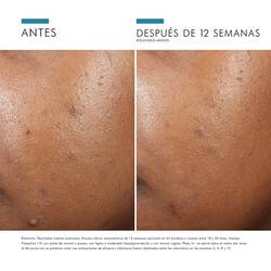 Phyto-A-Brightening-Treatment-Skinceuticals-5