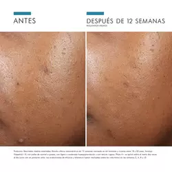Phyto-A-Brightening-Treatment-Skinceuticals-5