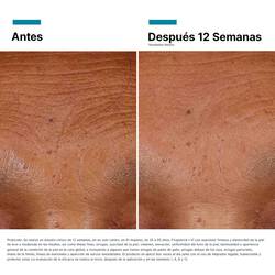 HA Intensifier Multi-Glycan Serum de acido hialuronico