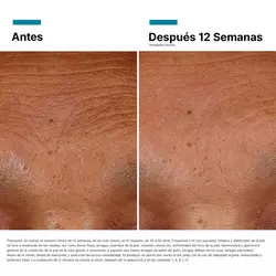 HA Intensifier Multi-Glycan Serum de acido hialuronico