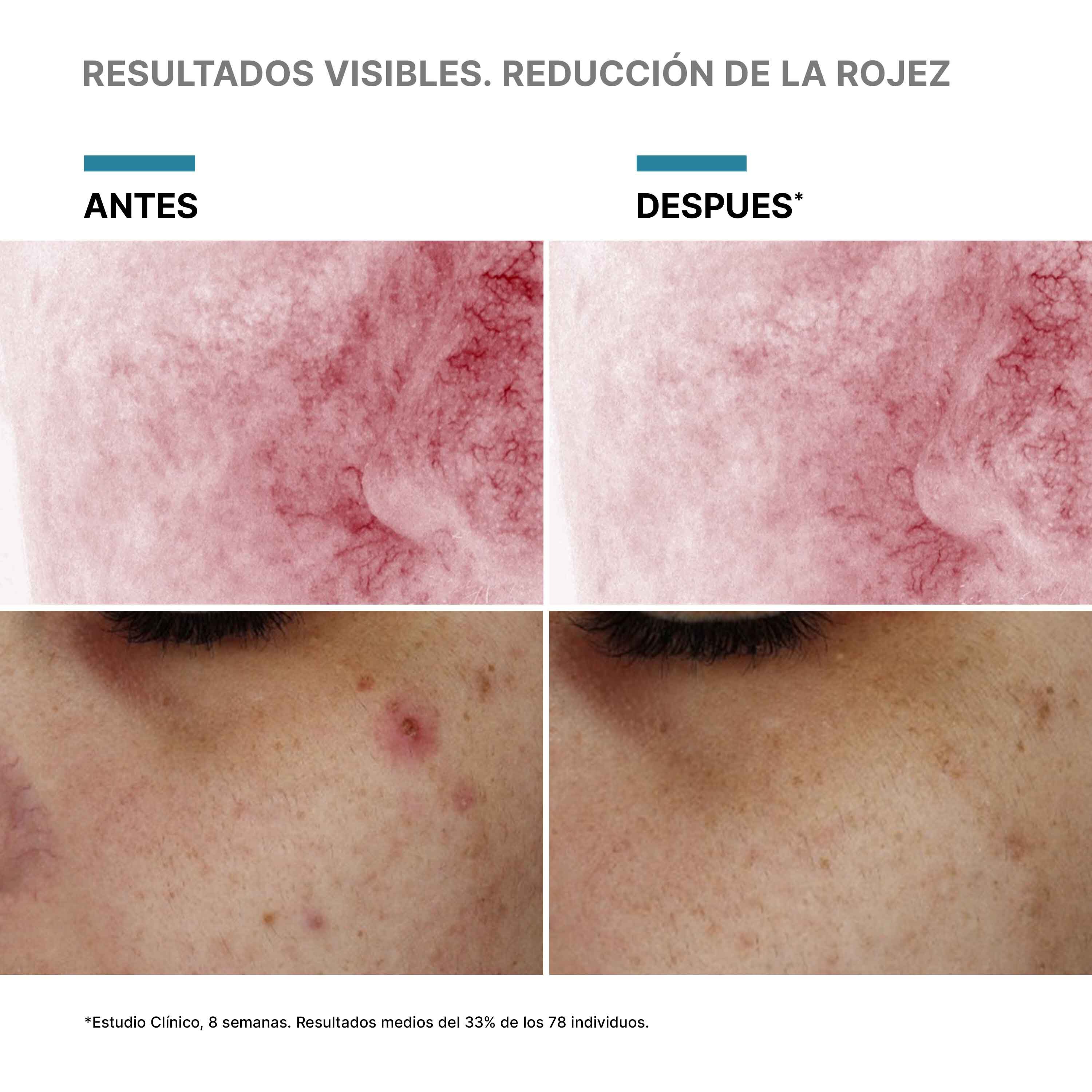 Serum con PDRN Phyto Corrective