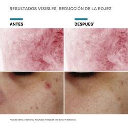 Serum con PDRN Phyto Corrective