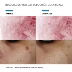 Serum con PDRN Phyto Corrective