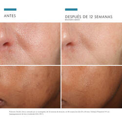 Phloretin-CF-30ml-SkinCeuticals-21