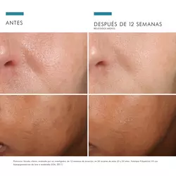Phloretin-CF-30ml-SkinCeuticals-21
