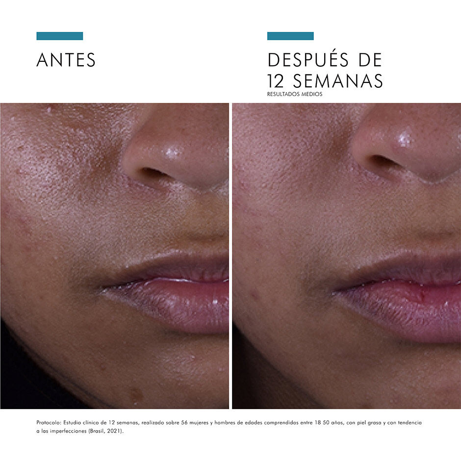 Silymarin-Cf-SkinCeuticals-5