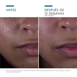 Silymarin-Cf-SkinCeuticals-5