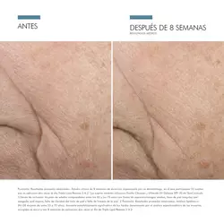 Triple-Lipid-Restore-242-Anti-Aging-Cream-48ml-SkinCeuticals-5