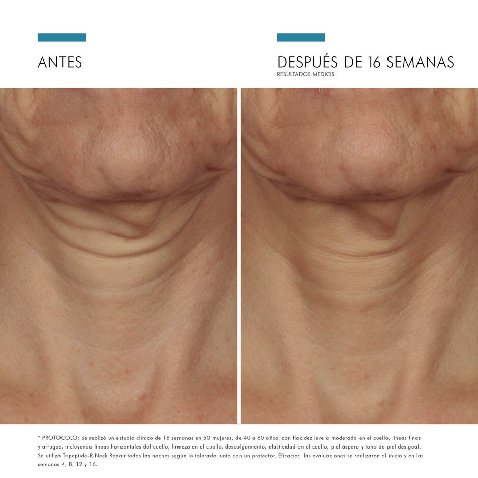 Tripeptide-R Neck Repair